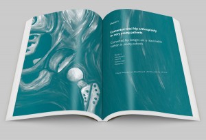 young osteoarthritic hip