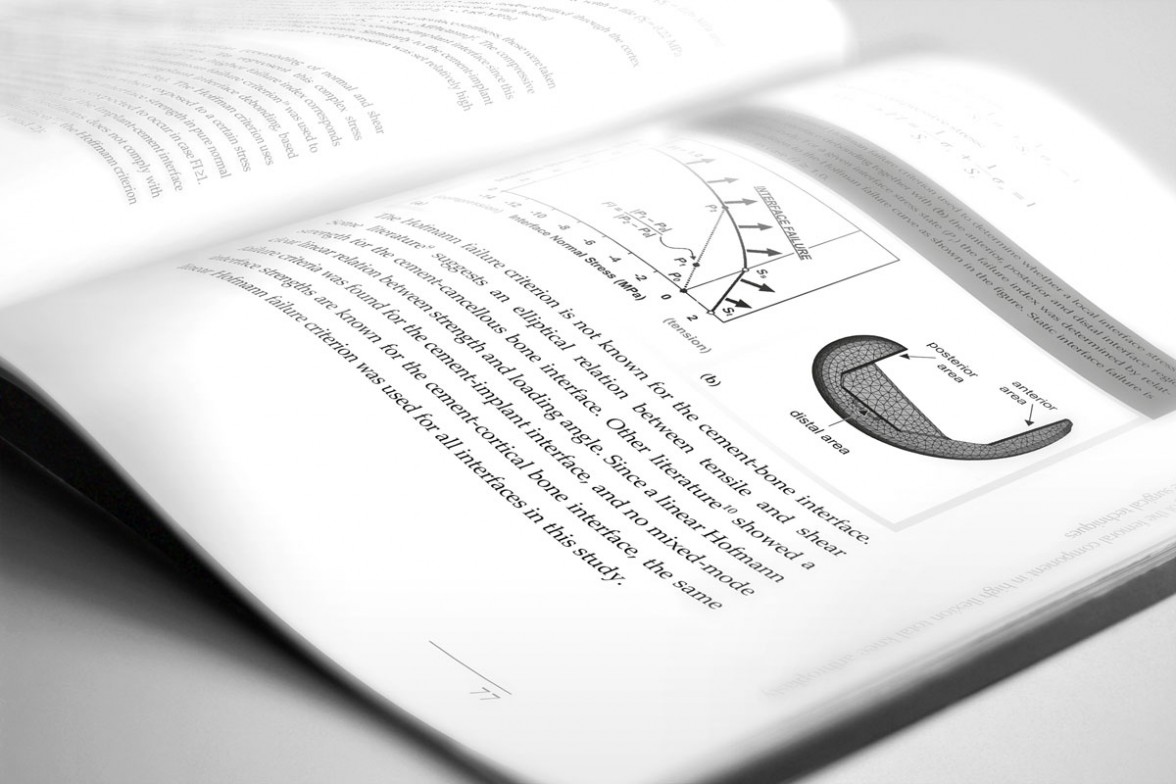 total knee arthroplasty