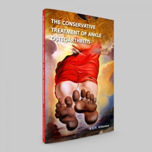 ankle osteoarthritis